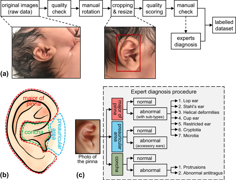 [Scientific Data] A publicly available newborn ear shape dataset for medical diagnosis of auricular deformities
