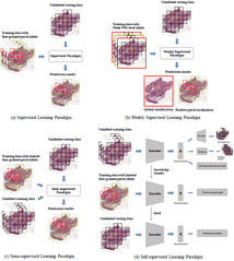 [Physics in Medicine and Biology] Towards Label-efficient Automatic Diagnosis and Analysis: A Comprehensive Survey of Advanced Deep Learning-based Weakly-supervised, Semi-supervised and Self-supervised Techniques in Histopathological Image Analysis