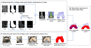 [Int J Med Robot Comp] Fusion of Multimodality Image and Point Cloud for Spatial Surface Registration for Knee Arthroplasty