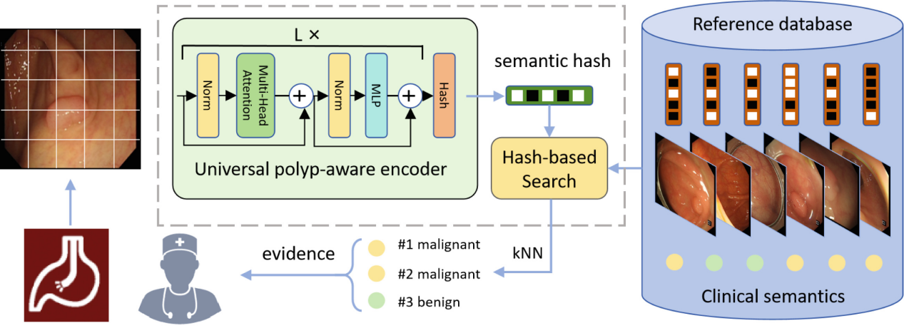 [MICCAI'24] EndoFinder: Online Image Retrieval for Explainable Colorectal Polyp Diagnosiss