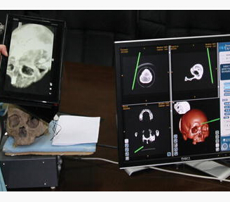 Multi-mode navigation in image-guided neurosurgery using a wireless tablet PC