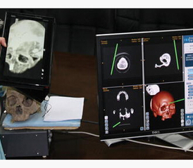 Multi-mode navigation in image-guided neurosurgery using a wireless tablet PC
