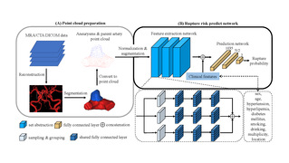 [Journal of NeuroInterventional Surgery] Prediction of Cerebral Aneurysm Rupture using a Point Cloud Neural Network