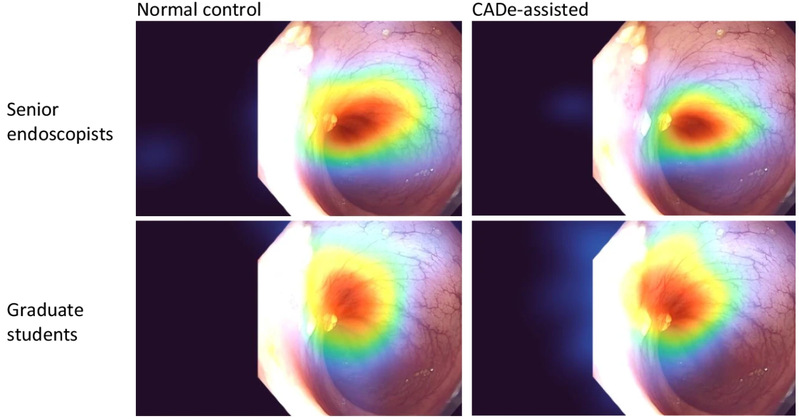 [Scientific Data] Eye-tracking dataset of endoscopist-AI teaming during colonoscopy: Retrospective and real-time acquisition