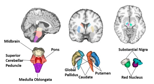 Robust Multi-atlas Label Propagation by Deep Sparse Representation