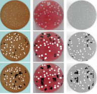 Detection and segmentation of virus plaque using HOG and SVM:Toward automatic plaque assay