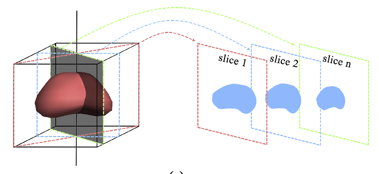 Rotationally Resliced 3D Prostate Segmentation Using Bhattacharyya Similarity and Active Band Theory