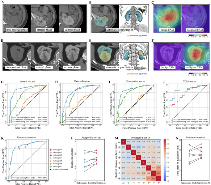 [Nature Communications] Artificial intelligence links CT images to pathologic features and survival outcomes of renal masses