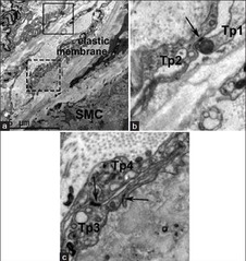 Morphological Evidence of Telocytes in Mice Aorta