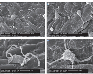 Scanning Electron microscope evidence of telocytes in vasulature