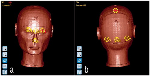 Accuracy Analysis of Line-Based Registration for Image Guided Neurosurgery at Different Operating…