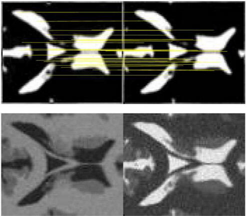 Manifold-based feature point matching for multi-model image registration